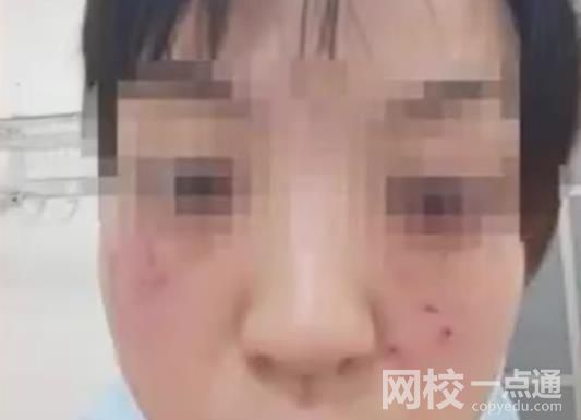 警方回應家長帶娃上門道歉被打傷 具體是什么情況?