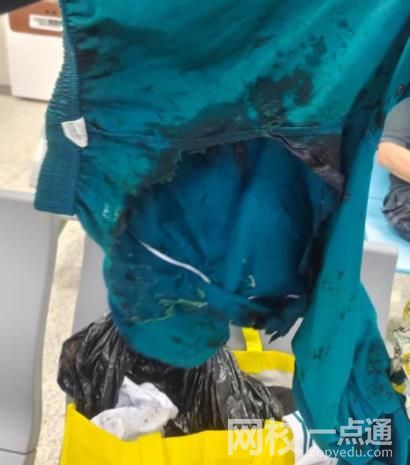 廣州警方通報男孩地鐵里被硫酸灼傷 具體是什么情況?