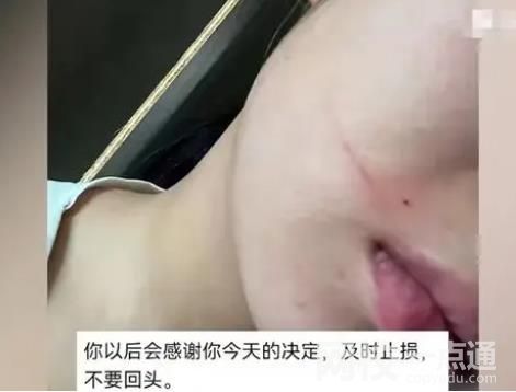 女子懷孕近7個月被丈夫施暴 女子表示不原諒會將小孩引產