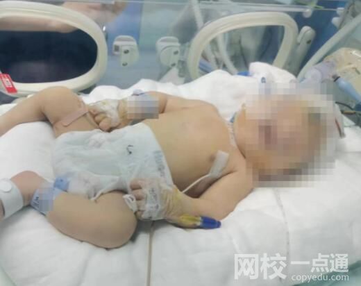嬰兒出生后顱骨骨折 醫院回應:需等待第三方醫療鑒定結果