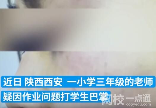 連扇學(xué)生數(shù)十耳光涉事老師被拘 內(nèi)幕曝光簡直太意外了