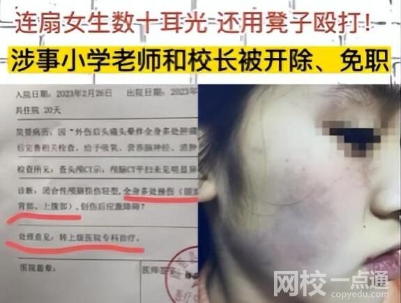 連扇學生數十耳光涉事老師被拘 內幕曝光簡直太意外了