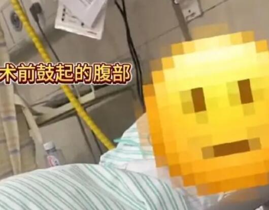 女子便秘20多年差點撐爆肚子 是什么原因造成的？