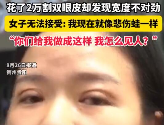 女子花2萬割雙眼皮控訴成了悲傷蛙 實在太悲劇了
