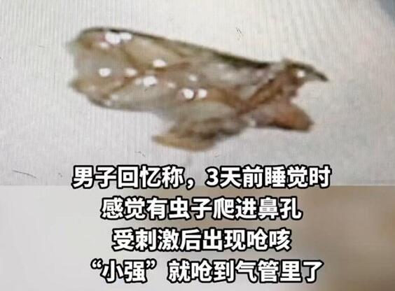 男子睡夢中蟑螂從鼻孔嗆進氣管 實在太嚇人了