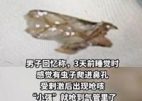 男子睡夢中蟑螂從鼻孔嗆進氣管 實在太嚇人了