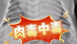 52天嬰兒喝奶奶喂的蜂蜜水中毒進ICU 究竟是怎么回事？