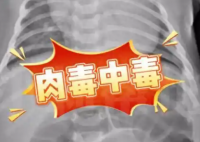 52天嬰兒喝奶奶喂的蜂蜜水中毒進ICU 究竟是怎么回事？