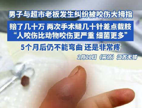 男子因糾紛被超市老板咬傷險截肢 背后真相實在讓人驚愕