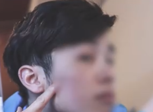 24歲小伙覺得自己太丑竟燒炭輕生 實在太嚇人了