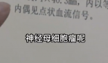 女孩因個矮去體檢發現腎上長腫瘤 這也太恐怖了