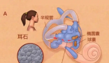 25歲女子長期熬夜打麻將患耳石癥 究竟是怎么回事？