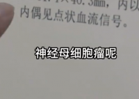 女孩因個矮去體檢發現腎上長腫瘤 這也太恐怖了