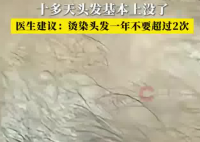 男子一月染頭4次致頭發大量脫落 實在太無奈了