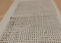 64歲大爺體內取出1791顆結石 這也太恐怖了