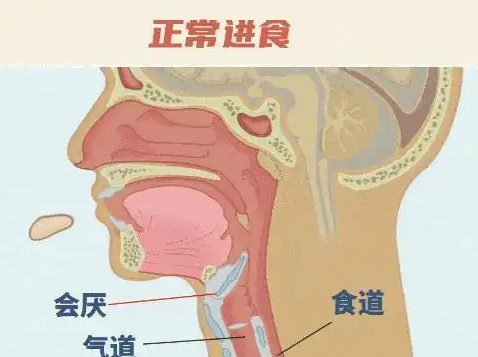 26歲女孩突發(fā)會厭炎僅10分鐘去世 實在太可怕了