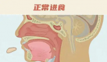 26歲女孩突發(fā)會厭炎僅10分鐘去世 實在太可怕了
