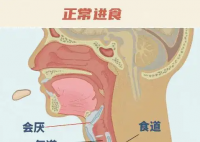 26歲女孩突發會厭炎僅10分鐘去世 實在太可怕了