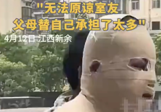 全身90%燒傷男生說父母借錢太心酸 究竟是怎么回事？