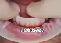 女子花6萬植12顆牙2年調試20多次 究竟是怎么回事？