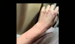女演員貴州拍戲遇極端天氣 胳膊受傷 實在太嚇人了